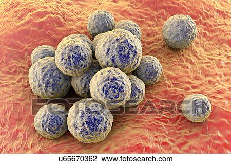 Stock Image - MRSA bacteria. Computer artwork of methicillin-resistant Staphylococcus aureus (MRSA) bacteria.. Fotosearch