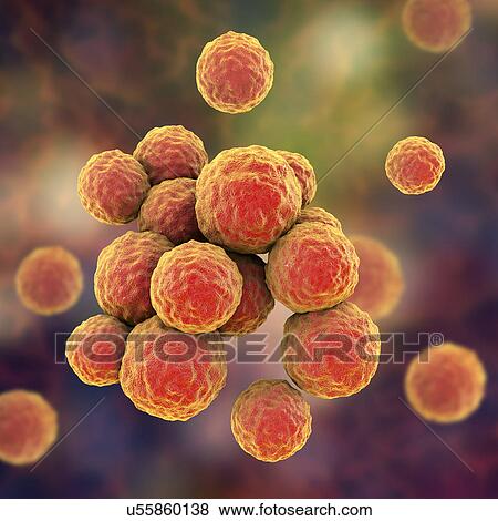 Stock Photo - MRSA bacteria. Computer artwork of methicillin-resistant Staphylococcus aureus (MRSA) bacteria.. Fotosearch