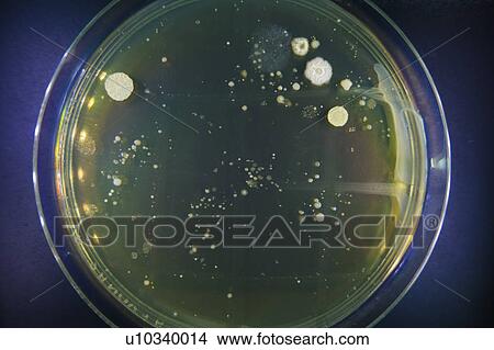 Picture - Petri dish with bacteria.. Fotosearch