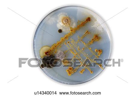 Picture - Petri dish with bacteria.. Fotosearch
