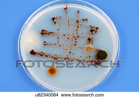 Picture - Petri dish with bacteria.. Fotosearch