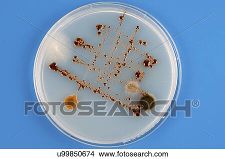 Picture - Petri dish with bacteria.. Fotosearch