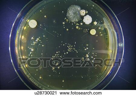 Stock Image - Petri dish with bacteria.. Fotosearch