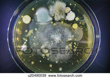 Stock Photo - Petri dish with bacteria.. Fotosearch