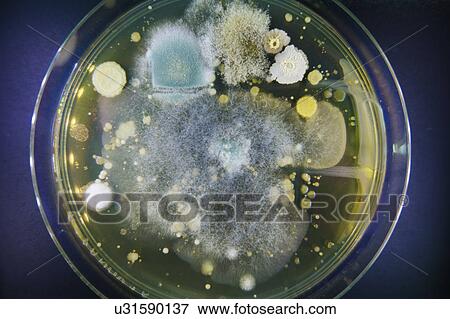 Stock Photo - Petri dish with bacteria.. Fotosearch