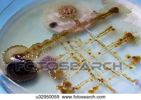 Stock Photo - Petri dish with bacteria.. Fotosearch