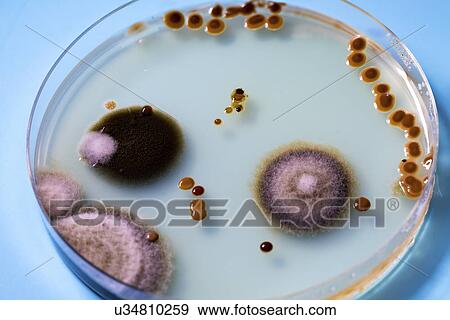 Stock Photo - Petri dish with bacteria.. Fotosearch