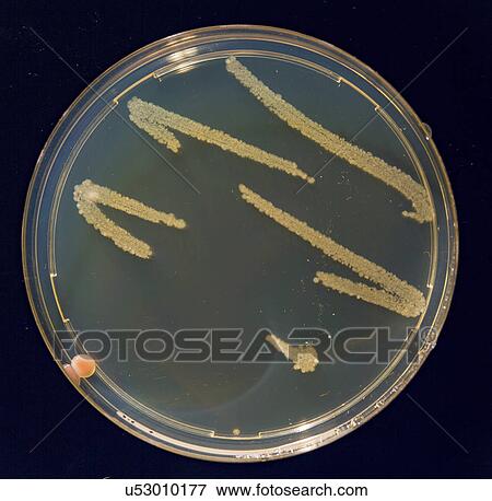 Stock Photo - Petri dish with bacteria.. Fotosearch