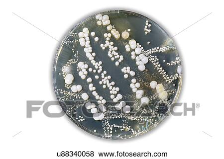 Stock Photo - Petri dish with bacteria.. Fotosearch