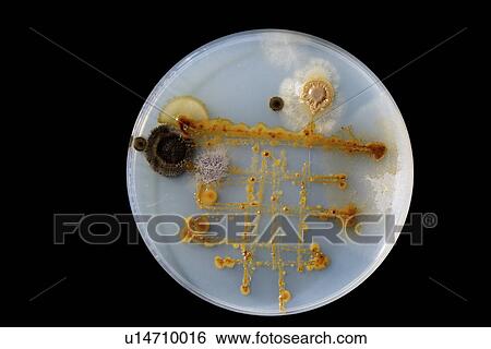 Stock Photograph - Petri dish with bacteria.. Fotosearch