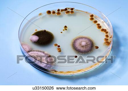 Stock Photograph - Petri dish with bacteria.. Fotosearch