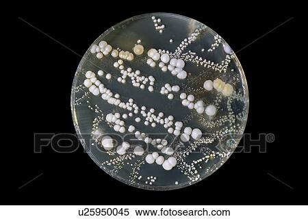 Petri dish with bacteria. View Large Photo Image Stock Photography - Petri dish with bacteria.. Fotosearch