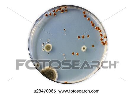 Stock Photography - Petri dish with bacteria.. Fotosearch