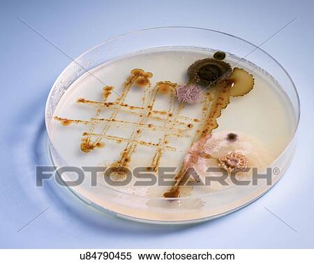 Stock Photography - Petri dish with bacteria.. Fotosearch