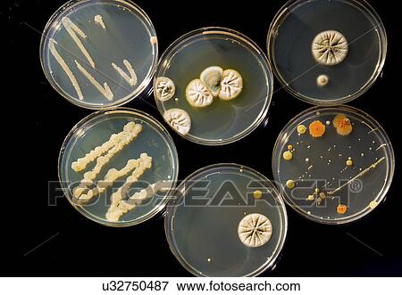 Stock Photo - Petri dishes with bacteria.. Fotosearch