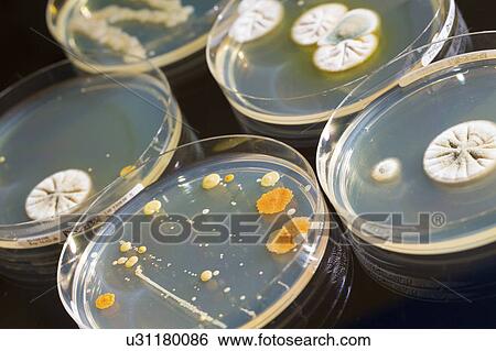 Stock Photograph - Petri dishes with bacteria.. Fotosearch
