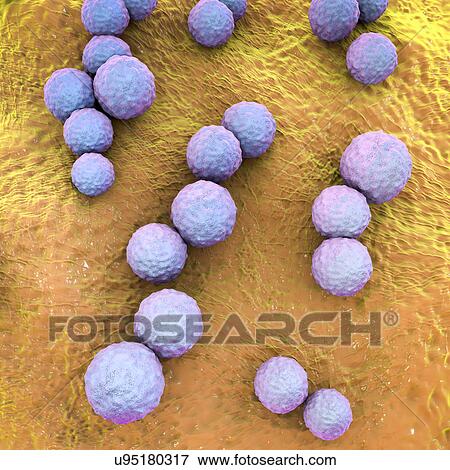 Stock Photo - Streptococcus mutans bacteria, computer illustration. These are Gram-positive, non-motile, spherical bacteria (cocci) which typically form chains of cells (as seen here). Streptococcus mutans is found in the mouth cavity. It is one of the principal.... Fotosearch