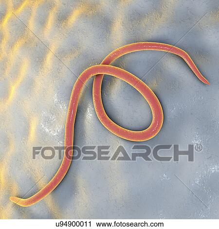Stock Image - Threadworm, computer illustration. Threadworms are nematode worms that parasitize the large intestine and caecum of many animals. In humans they cause the common infection enterobiasis. Nematodes are unsegmented worms that may be parasitic or.... Fotosearch