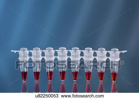 Stock Image - Vials containing blood samples.. Fotosearch