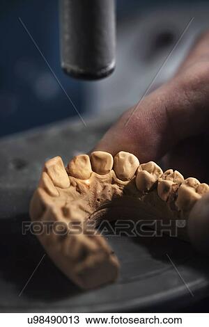 Dental mold, close up. View Large Photo Image Stock Image - Dental mold, close up.. Fotosearch