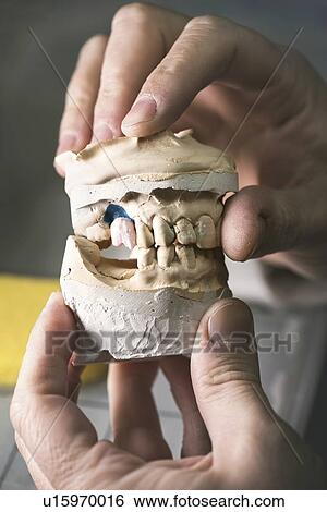 Dental mold with prosthetic tooth, close up. View Large Photo Image Stock Photograph - Dental mold with prosthetic tooth, close up.. Fotosearch