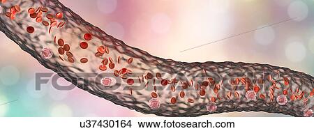 Picture - Blood vessel with blood cells, illustration. Fotosearch