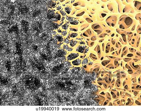 Stock Photo - Bone structure and nanomaterial, artwork. Fotosearch