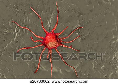 Stock Image - Cancer cell, illustration. Fotosearch