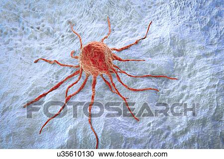 Cancer cell, illustration View Large Photo Image Stock Image - Cancer cell, illustration. Fotosearch