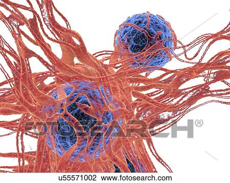Stock Image - Cancer cell, illustration. Fotosearch