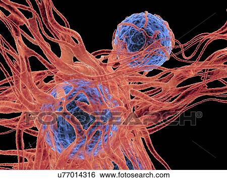 Stock Photograph - Cancer cell, illustration. Fotosearch