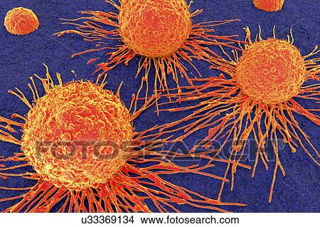 Picture - Cancer cells, illustration. Fotosearch