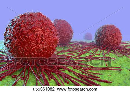 Stock Image - Cancer cells, illustration. Fotosearch