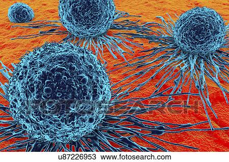 Stock Image - Cancer cells, illustration. Fotosearch