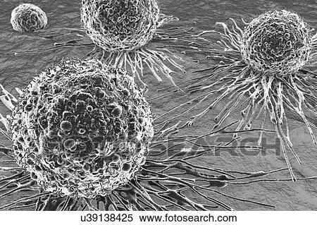Stock Photography - Cancer cells, illustration. Fotosearch