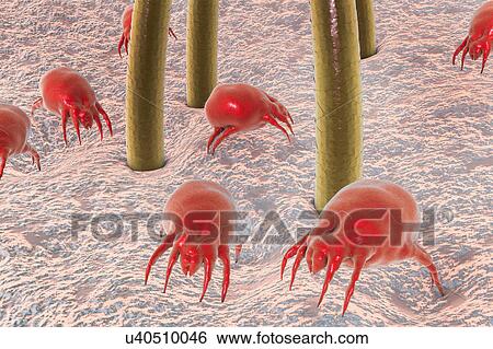 Stock Photograph - Dust mite, illustration. Fotosearch