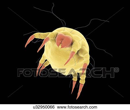 Stock Photograph - Dust mites on human skin, illustration. Fotosearch