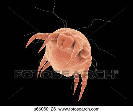 Dust mites on human skin, illustration View Large Photo Image Stock Photograph - Dust mites on human skin, illustration. Fotosearch