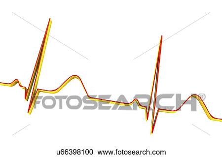 Stock Image - ECG, illustration. Fotosearch