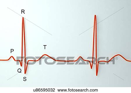 Stock Image - ECG, illustration. Fotosearch