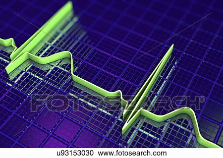 Stock Image - ECG, illustration. Fotosearch