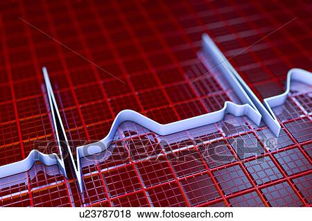 Stock Photo - ECG, illustration. Fotosearch