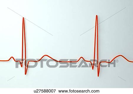 Stock Photo - ECG, illustration. Fotosearch