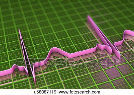 Stock Photo - ECG, illustration. Fotosearch