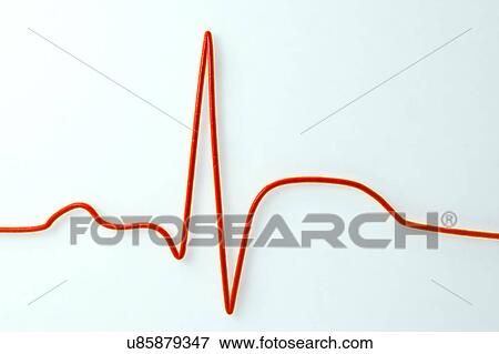 Stock Photo - ECG in myocardial infarction, illustration. Fotosearch