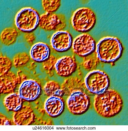 Picture - Hantavirus particles, TEM. Fotosearch