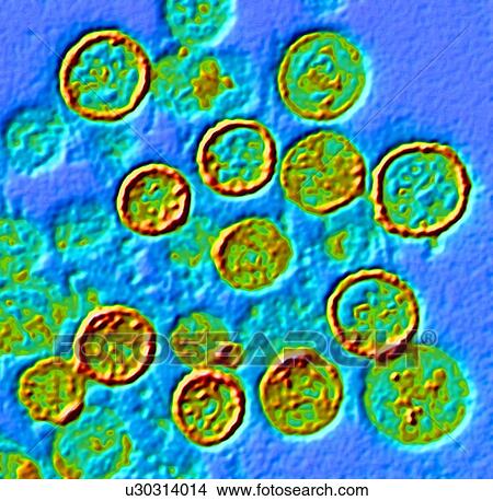 Picture - Hantavirus particles, TEM. Fotosearch