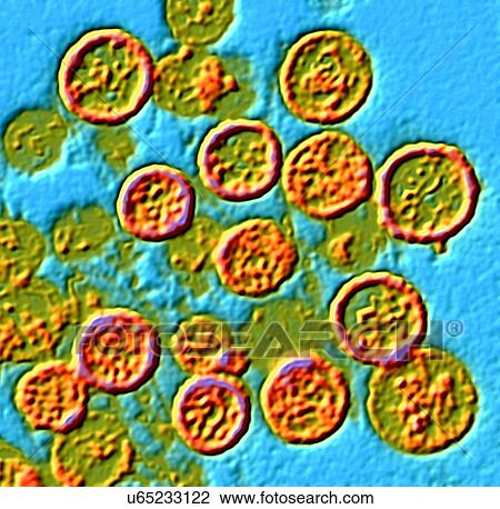 Stock Image - Hantavirus particles, TEM. Fotosearch