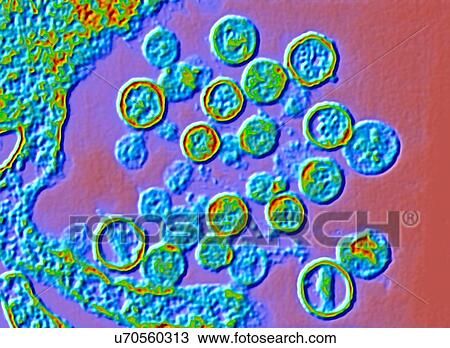 Stock Image - Hantavirus particles, TEM. Fotosearch