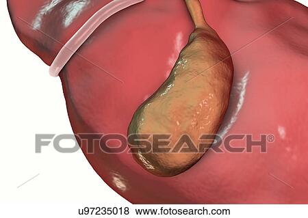 Stock Photo - Healthy gallbladder, illustration. Fotosearch